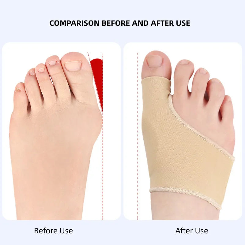 1Pair Toe Separator Hallux Valgus Bunion Corrector Hammer Toe Straightener Foot Pain Relief Orthopedic Pedicure Tools Foot Care