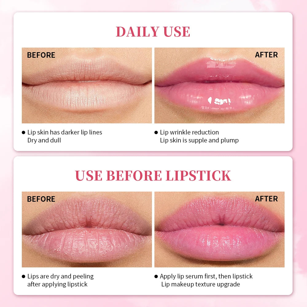 ibcccndc Pink Lip Serum Lotion Moisturizes Moisturizes And Plump Lips Removes Dead Skin Pink Lip Essence Brightener Use Of  Face