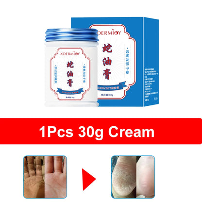 Herbal Anti Crack Foot Cream Heel Cracking Repair Products Exfoliation Dead Skin Removal Softening Moisturize Smooth Skin Care