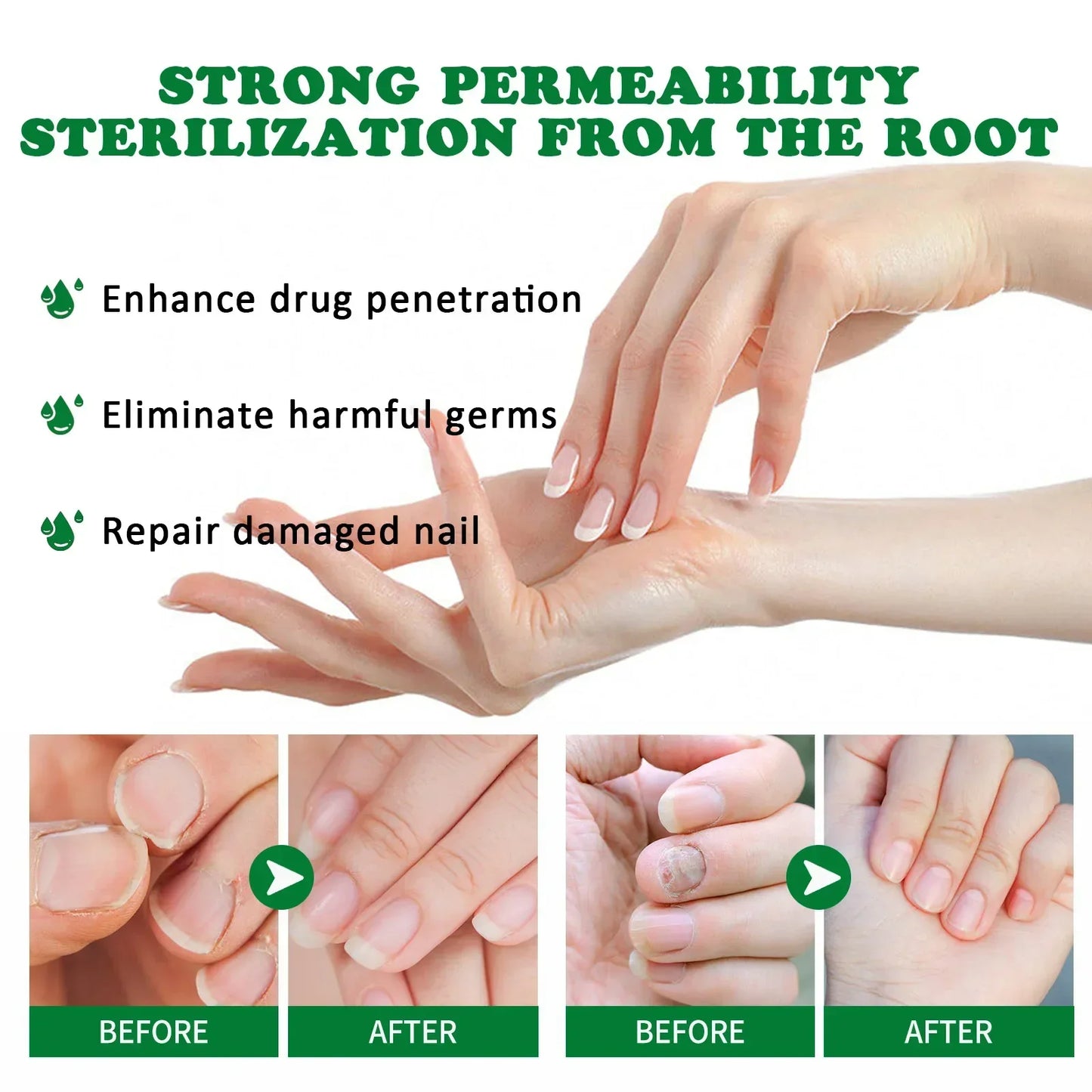 7 Days Nail Fungal Treatment Essence Oil Foot Toe Nail Fungus Removal Serum Repair Onychomycosi Anti Infection Gel Care Products