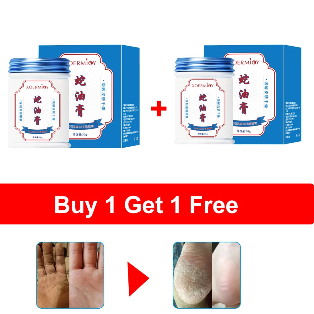 Herbal Anti Crack Foot Cream Heel Cracking Repair Products Exfoliation Dead Skin Removal Softening Moisturize Smooth Skin Care