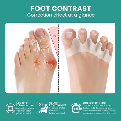 1 Pair Silicone Toe Separator, Bunion Corrector, Hammer Toe Corrector, Soft Silicone Material for Toe Separation Foot Care Tool