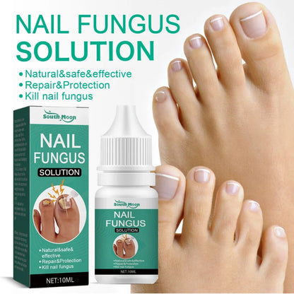 Extra Strong Nail Fungus Treatment Serum Essence oil Feet Nails Repair Care Essence Cream Anti Infection Toe Fungal Removal