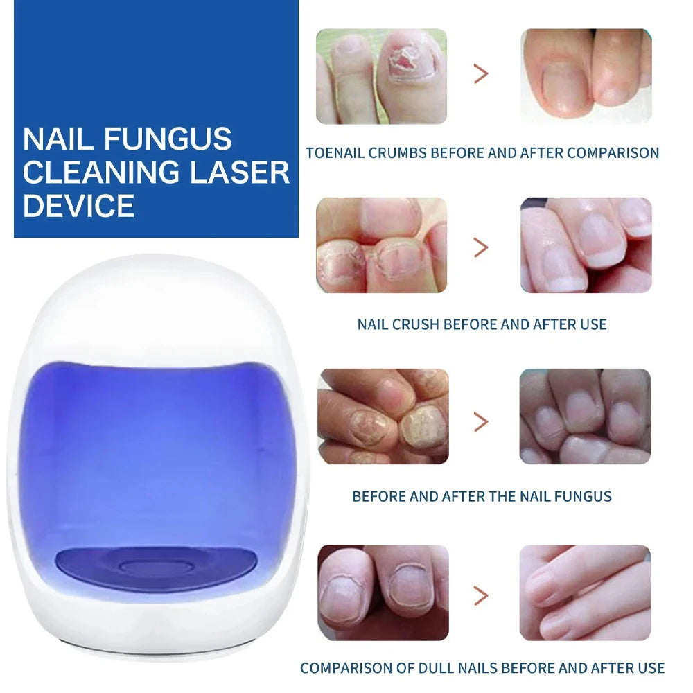 Toenail Nail Fungus Treatment Repair Fingernail Device Toenail Treatment for Foot Nail Fungus Essential Oil Onychomycosis Care