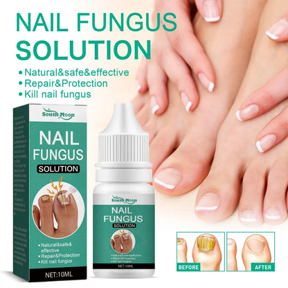 Extra Strong Nail Fungus Treatment Serum Essence oil Feet Nails Repair Care Essence Cream Anti Infection Toe Fungal Removal