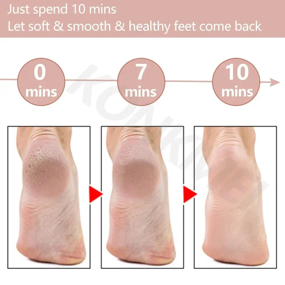 Electric Foot Grinding Skin Hard Rupture Skin Trimmer Dead Skin Foot Pedicure Rechargeable Foot Care Tool Feet Callus Remover