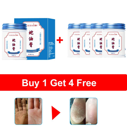 Herbal Anti Crack Foot Cream Heel Cracking Repair Products Exfoliation Dead Skin Removal Softening Moisturize Smooth Skin Care